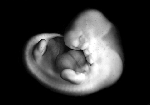 фото эмбриона до 6й недели