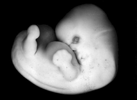 фото развития эмбриона
